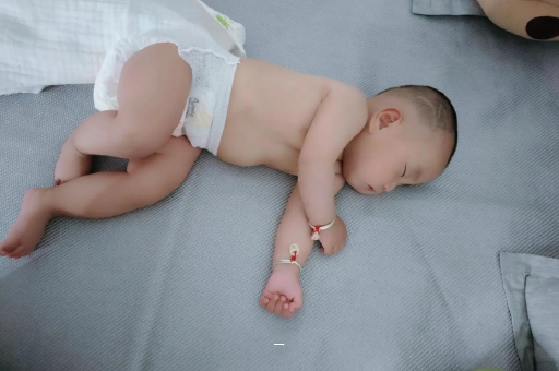 白银宝宝脸上有白色斑块